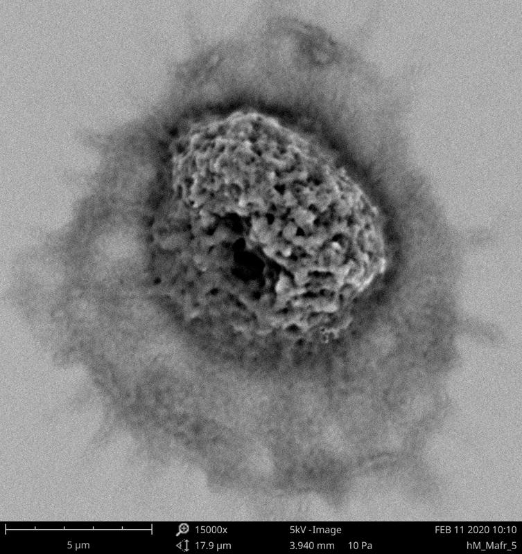 Scanning electron micrograph of a human macrophage at 15000x magnification after phagocytosis of Y-irradiated, inactivated M. africanum. 