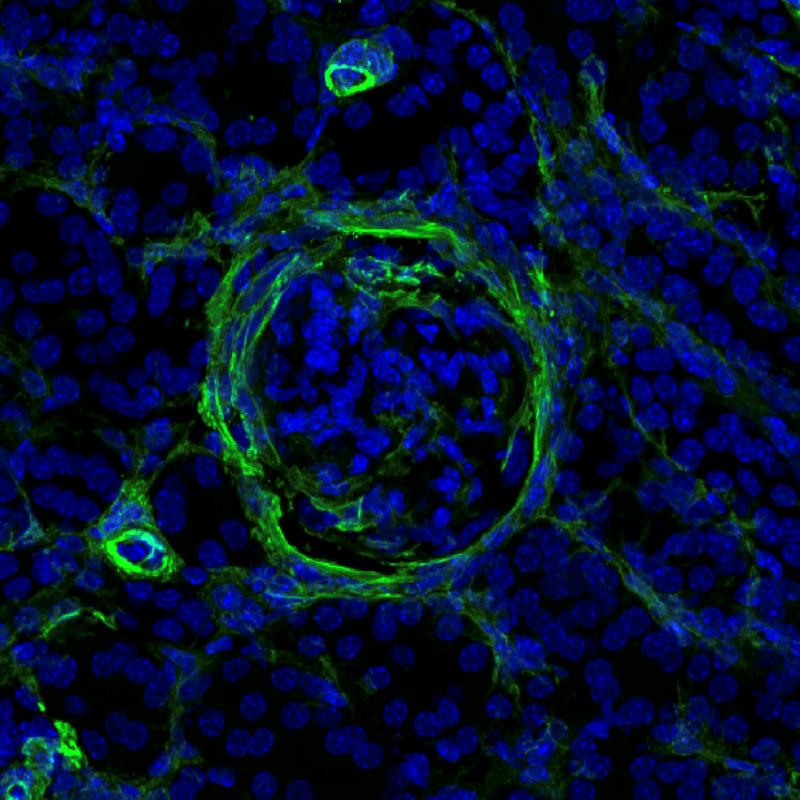 Nierengewebe (Lupus-Mausmodell) mit Zeichen von beginnender Fibrose (grün). Blockiert man den NKp46-Rezeptor der ILC-Zellen, geht die Lupus-Nephritis zurück. Blau: Zellkerne.