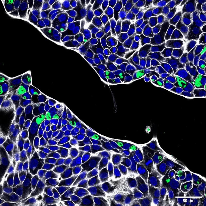 Immunofluorescence staining of human gastric cells grown in a microplate and infected with Chlamydia trachomatis. Blue: cell nuclei, green: C. trachomatis, grey: actin.