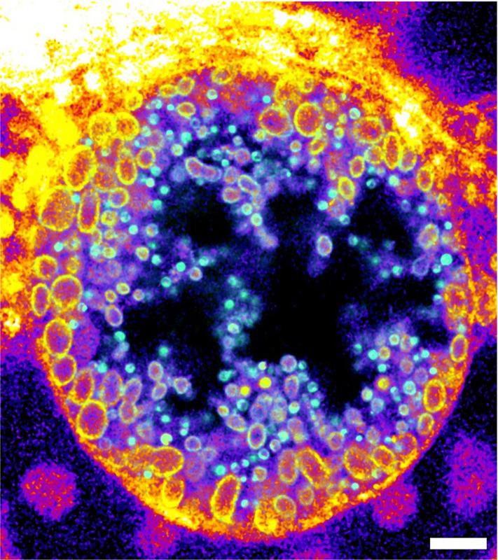 Chlamydia inclusions in infected human cells, the native sphingomyelin derivative in non-infectious reticulate bodies (yellow circles) and the metabolized derivative (green dots) in infectious elementary bodies.