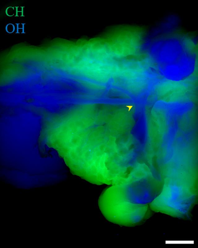  SWIR-Raman-Bildgebung der Bereiche mit chemischen OH- und CH-Bindungen in einem chirurgischen Modell eines in Fettgewebe eingebetteten Gesichtsnervs eines Modells.