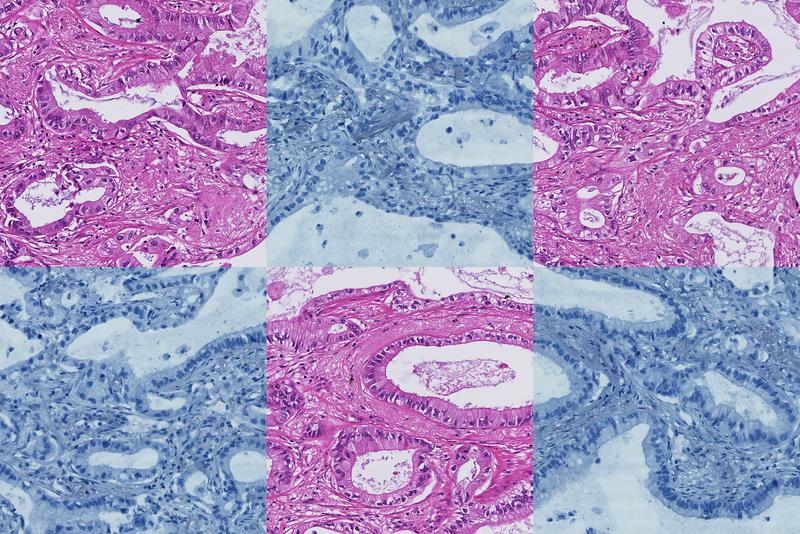 Das Bildregistrierungsverfahren Histokat-Fusion überträgt Annotationen aus zwei histologischen Färbungen aufeinander.