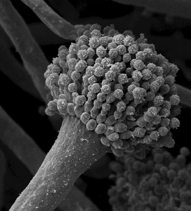 Scanning electron micrograph of a spore carrier of 𝘈. 𝘧𝘶𝘮𝘪𝘨𝘢𝘵𝘶𝘴. The numerous spherical spores are known as conidia.