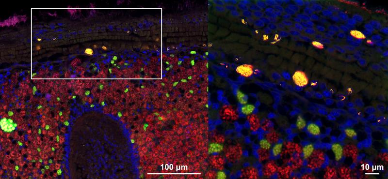 Microscopy image (fluorescence in situ hybridization (FISH) confocal microscopy) of tissues from a deep-sea mussel showing the intranuclear parasite Ca. Endonucleobacter in yellow, and the beneficial symbiotic bacteria in green and red. 