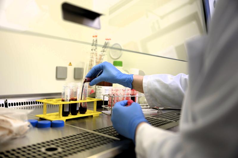 Mithilfe einer von Prof. Petra Bacher und Prof. Alexander Scheffold entwickelten Methode konnten die Forschenden aus der großen Menge verschiedener Immunzellen im Blut gezielt die seltenen autoreaktiven Immunzellen anreichern und analysieren.