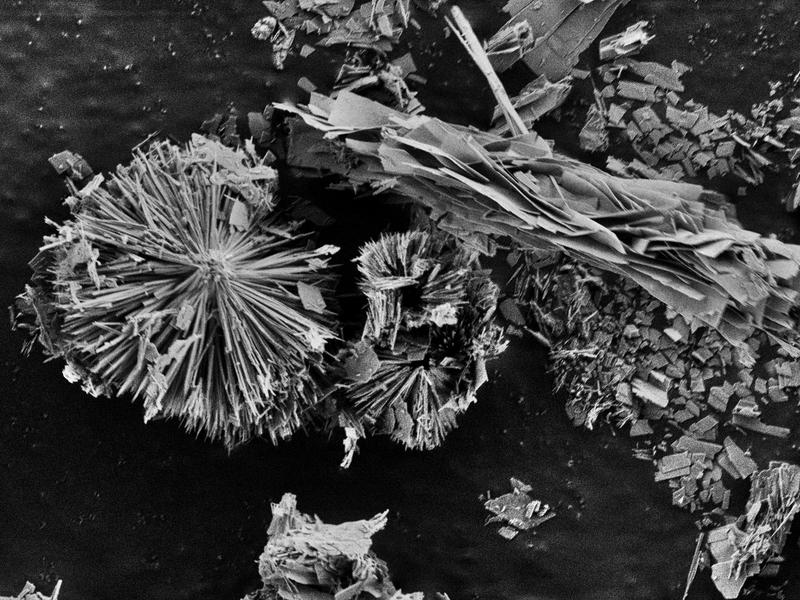 Unter dem Rasterelektronenmikroskop zeigt die Oberfläche eines Vanadiumcarbid-MXens interessante, fast organisch wirkende Strukturen aus  Kobalt-Kupfer-Hydroxid-Molekülen.