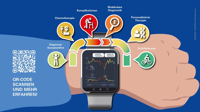 Durch den Einsatz personalisierter Krebstherapie konnte ein 56-jähriger Patient mit seltenem Bauchspeicheldrüsenkrebs schnelle Fortschritte erzielen. Die Smartwatch überwachte den Krankheitsverlauf und erkannte frühzeitig den Therapieerfolg. 