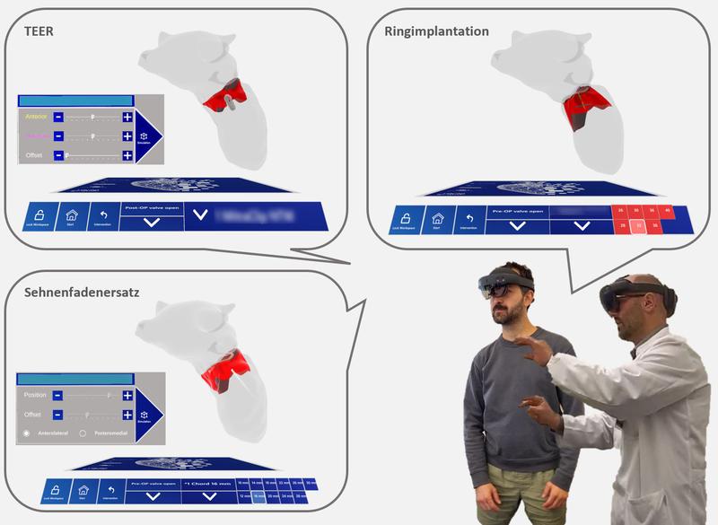 MINIMAKI ermöglicht Patient:innenaufklärung und Planung von Herzklappeneingriffen mittels Mixed Reality. Virtuell können Therapieoptionen ausgewählt und der Einsatz eines passenden Implantats simuliert werden.