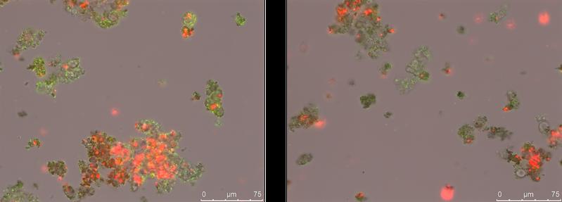 Mikroskopische Aufnahmen einer Kultur phototropher Eisenoxidierer (Rhodobacter ferrooxidans SW2). Die lebenden Bakterien (in grün angefärbt) sind auf, an und in den gebildeten Eisenmineralen zu sehen.