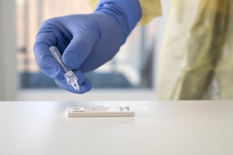 In der Pandemie wurden am Uniklinikum Würzburg von Nov. 2020 bis Juni 2023 über 100.000 SARS-CoV-2-Antigenschnelltests durchgeführt, deren Testperformance Manuel Krone und Isabell Wagenhäuser im Pandemieverlauf verfolgt und fortlaufend ausgewertet haben.