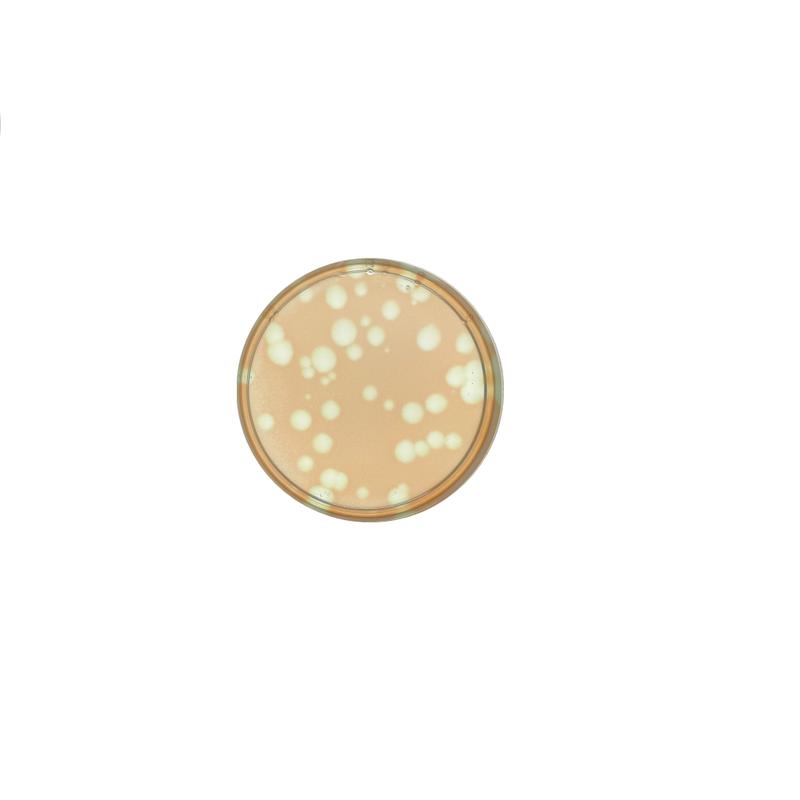 Agarplatte mit marinen Cyanobakterien der Art Synechococcus sp. (rötliche Färbung = Bakterienrasen), die von Phagen befallen sind. Wo Befall auftritt, entsteht eine sogenannte Plaque (klare Zone). 