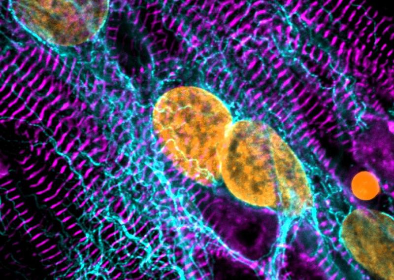 Induzierte pluripotente Stammzell-Kardiomyozyten, gefärbt für das sarkomerische Protein ACTN2 (lila), detyrosinierte Mikrotubuli (cyan) und DNA (orange), aufgenommen mit der konfokalen Mikroskopie bei 63-facher Vergrößerung. 