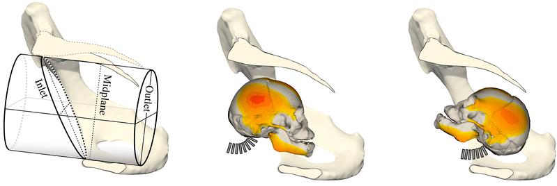 3D-Simulation des Geburtskanals von Schimpansen mit (B) Kopf des Fötus in vollständig überstreckter Position, die typische Kopfausrichtung bei Affen und (C) Kopf des Fötus in vollständig gebeugter Position, die übliche Kopfausrichtung beim Menschen.