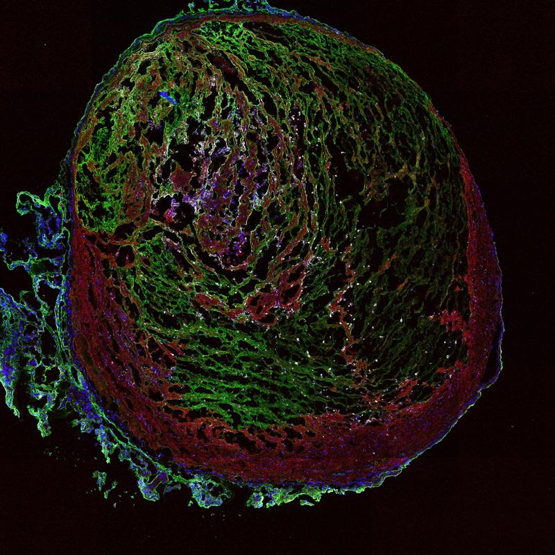 Ein Thrombus aus der Vene einer Maus, der die in der Studie beschriebenen prokoagulanten Plättchen (weiß Punkte) nachweist