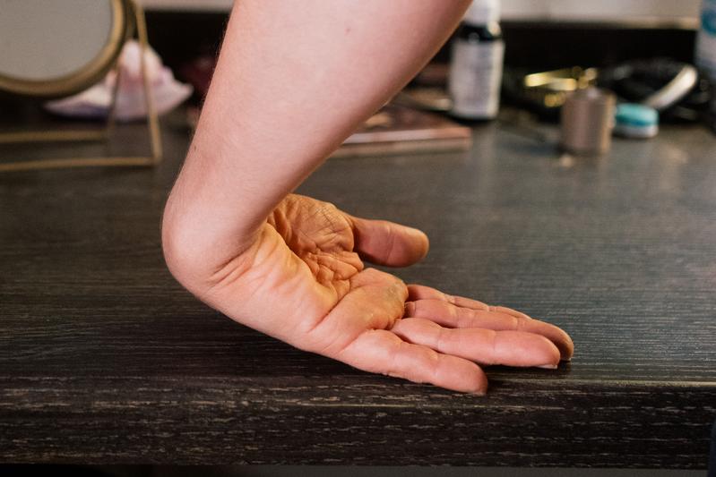 Ein Handgelenk lässt sich weit verbiegen – und zwar weiter, als wir uns in Gedanken ausmalen.