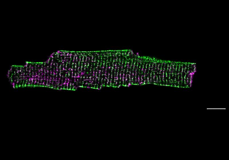 STED-Mikroskopie einer isolierten Herzmuskelzelle. Dargestellt ist die Lokalisation des Membranreparaturproteins Dysferlin (magenta) entlang des filigranen Membrannetzwerkes innerhalb der Muskelzelle (Caveolin-3, grün). Zellübersicht, Maßstab 10 µm. 