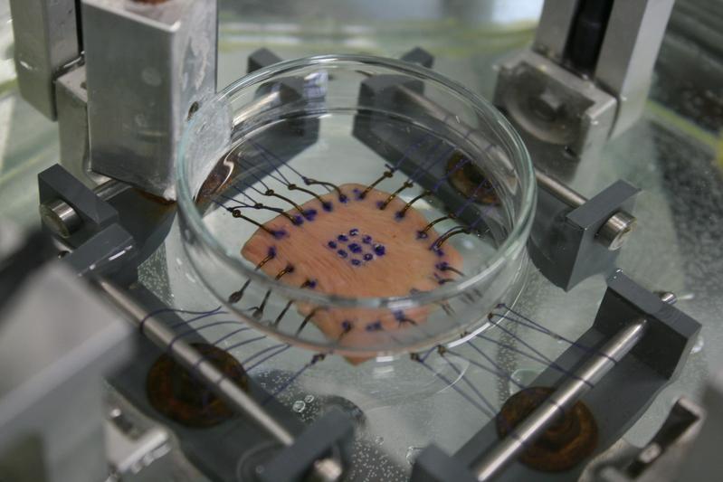 Eine vorbereitete Myokardprobe in einer biaxialen Prüfmaschine.