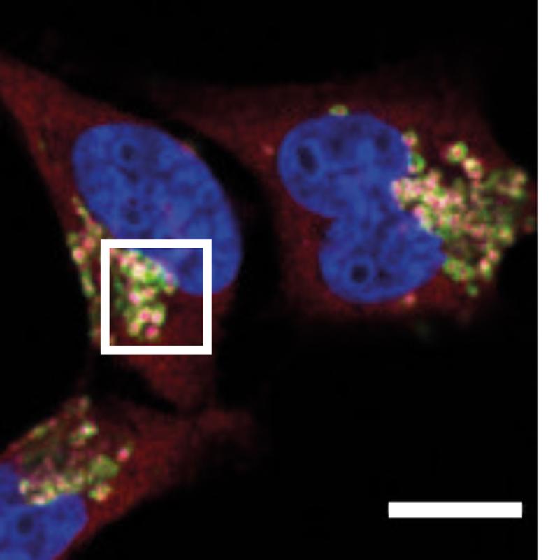 Once cells’ quality control mechanism is activated, IRGQ (red) accumulates in special cell organelles, the lsysosomes (green). This is also where the degradation of the non-functional MHC-I molecules takes place. 