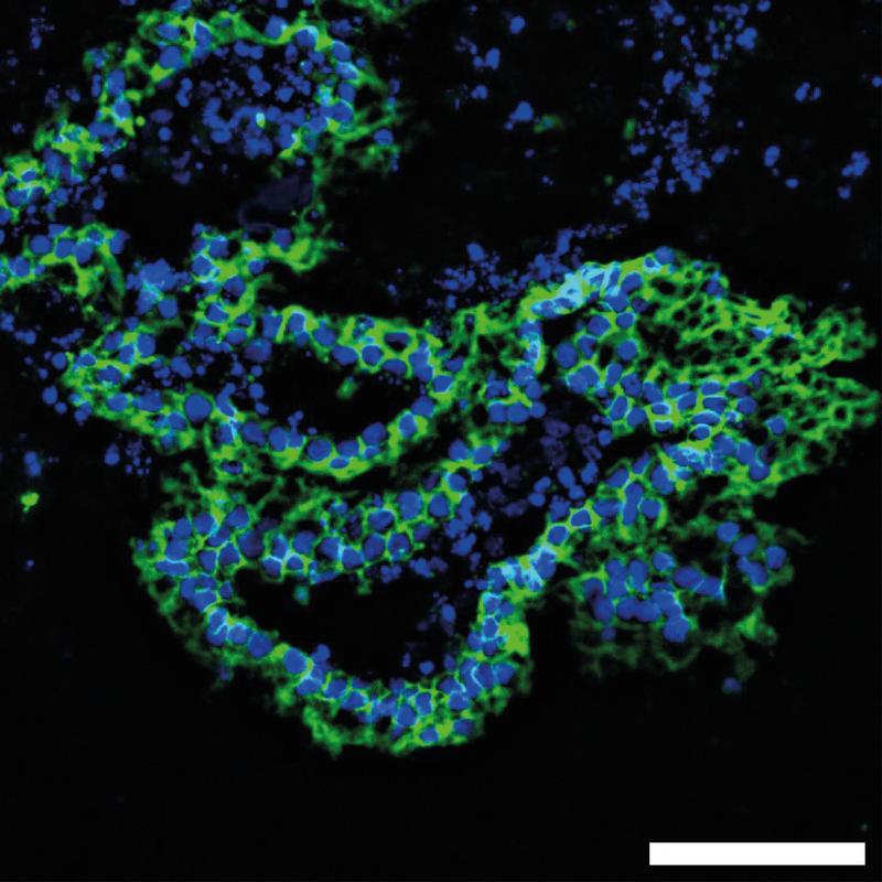 A fluorescent microscopy image of a branching lung organoid which was generated using human induced pluripotent stem cells. The lung epithelial cell boundaries are stained in green. Nuclei are stained in blue. Scale bar: 75 µm.