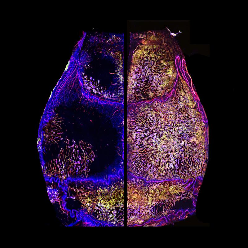 Lifelong vascular growth and bone marrow expansion of the skull. Skull bone marrow vessels of a young adult (left) and a geriatric (right) mouse (red: CD31, green: Endomucin, blue: DAPI).
