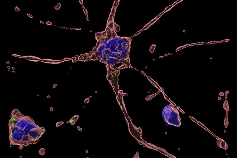 Mit Hepatitis E infizierte primäre Neurone aus menschlichen Nierenzellen, die mit dem Urin ausgeschieden werden 