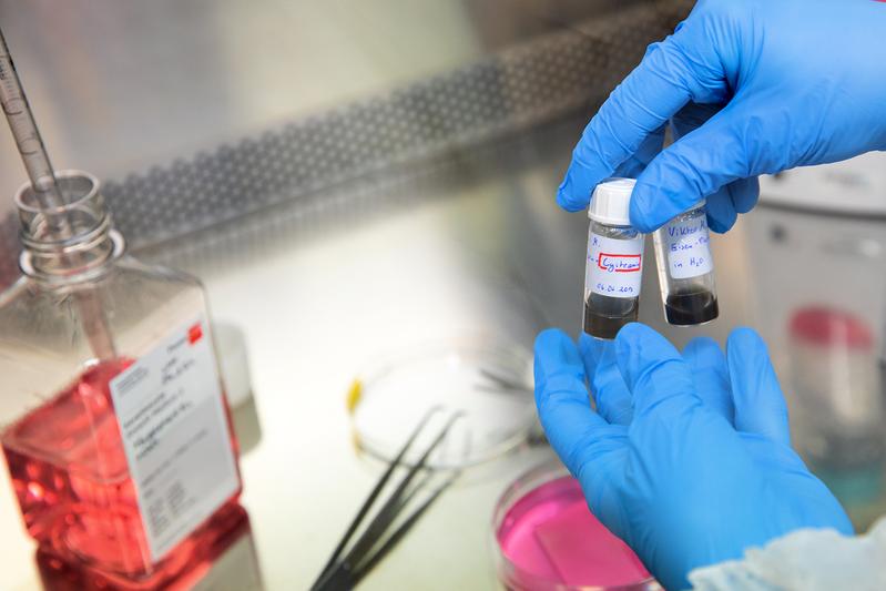 Medikamentenentwicklung zur Behandlung Schwerstverbrannter: neues Biopharmazeutikums soll Abstoßung transplantierter Spenderhaut unterdrücken. 