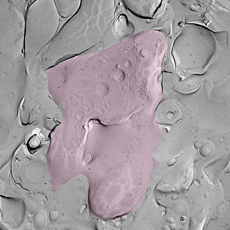 Like the surface of the moon. Freeze fracture replica of mossy fiber ending (pink) with visible synaptic vesicles inside and immunogold labeling (black dots) on the membrane surface. 