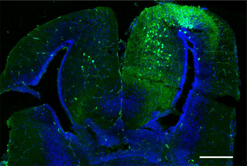 A coronal section of the frog forebrain showing AAV-mediated labeling of neurons. AAV-infected cells, green; cell nuclei, blue. Scale bares, 400 µm. 