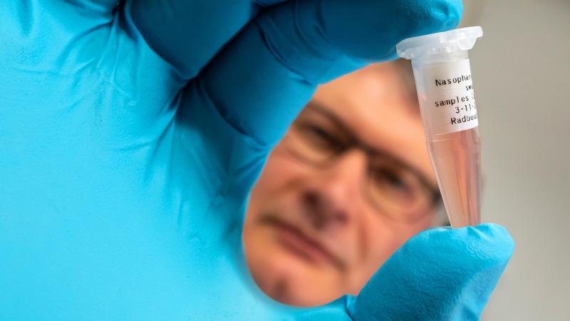 Dr. David Kaiser hält eine Probe eines Nasenabstrichs, die mit Hilfe des entwickelten Sensors auf spezifische Biomarker untersucht wird.