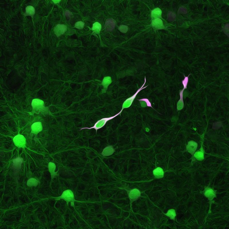 Stilisierte Darstellung von Tollwutvirus-infizierten Tumorzellen (in magenta und grün) und den direkt mit ihnen verbundenen Nervenzellen (grün).