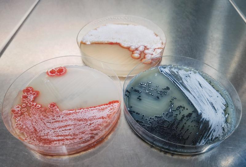 Cultures of different Streptomyces strains.