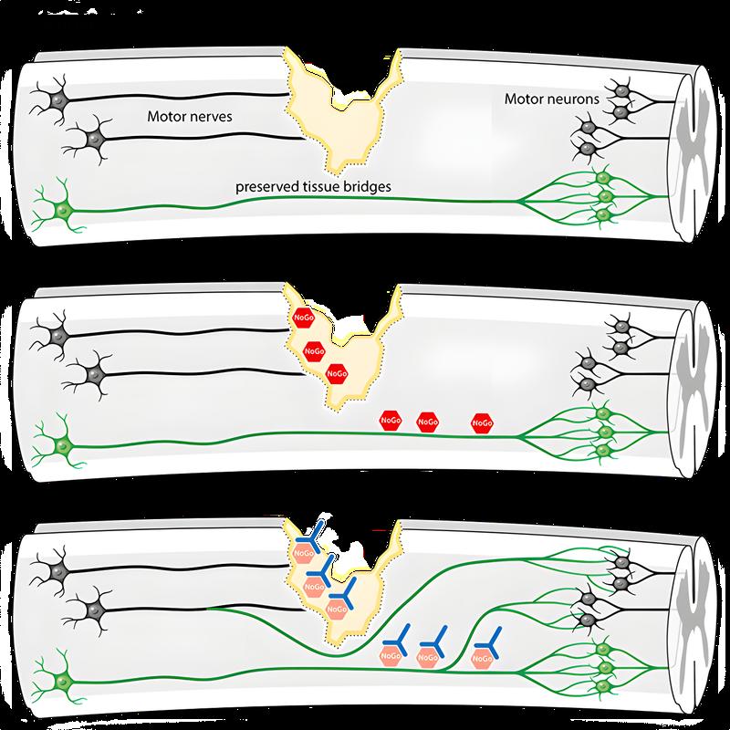 Top: Disruption of nerve pathways due to acute spinal cord injury, Middle: Inhibitory molecules block new connections, Bottom: Antibodies neutralize inhibitory molecules and enable improved motor recovery