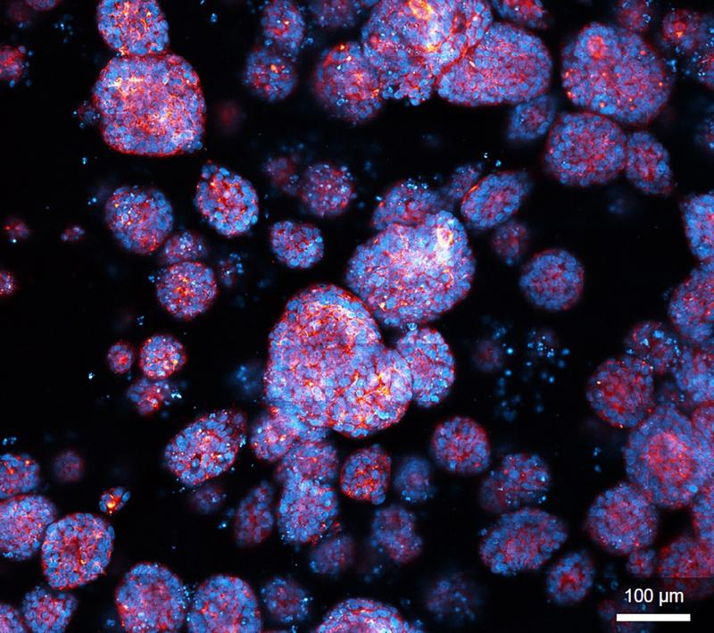 Organoid-Kultur mit Organoiden unterschiedlicher Größe und Zellzusammensetzung, hier kenntlich gemacht durch Anfärbung des Zellgerüsts (rot) und der Zellkerne (blau).