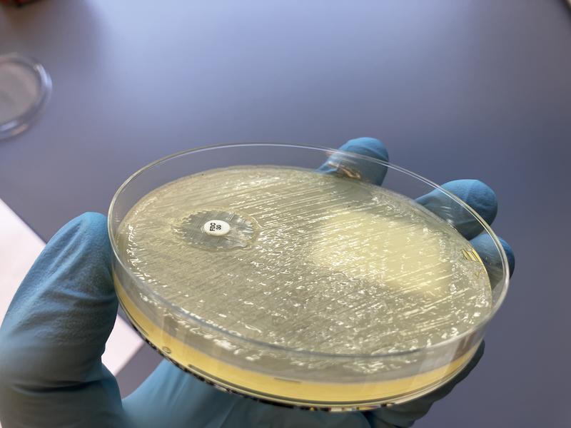 Die isolierten Bakterien wurden mittels Agar-Diffusionstest auf ihre Antibiotikaresistenz überprüft