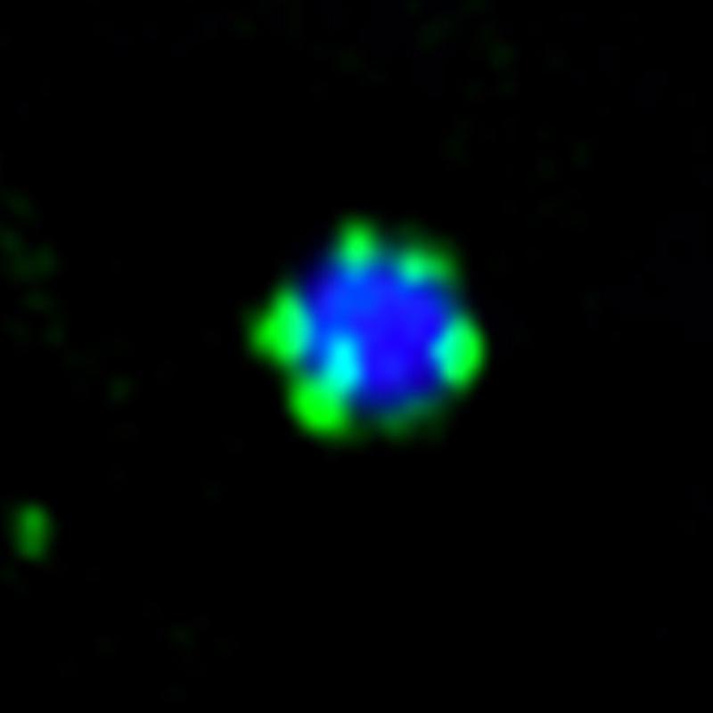 Unter dem Fluoreszenzmikroskop: Das Molekül Atg11 (grün) bildet kleine Tröpfchen auf der Oberfläche eines Protein-Aggregats (blau).