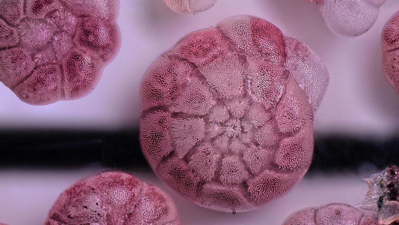 Weltweit gibt es mehrere Tausend Arten Foraminiferen. Zehn bis 20 leben im deutschen Wattenmeer, darunter Ammonia confertistesta. Ihr grünlich-gelbes Zellplasma wurde für die Untersuchung rosa eingefärbt und mit dem Mikroskop 300-fach vergrößert. 