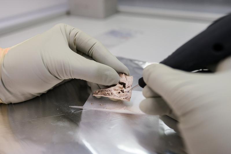 Today, ancient DNA (aDNA) can be extracted from the bones and teeth of people who lived thousands of years ago. It contains valuable information about past lifestyles, illnesses and evolutionary protection against diseases. 