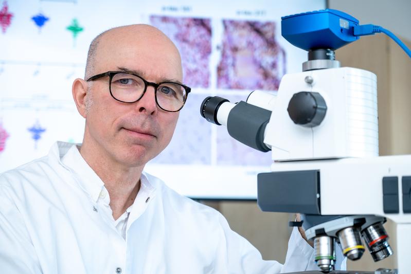 Professor Markus Otto at the microscope: In a study, he and his colleagues showed that p-tau proteins are not as accurate as hoped as biomarkers for blood tests for the early detection of Alzheimer's disease.