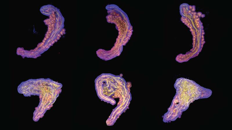 Collage of stem-cell-based embryo models of the embryonic trunk