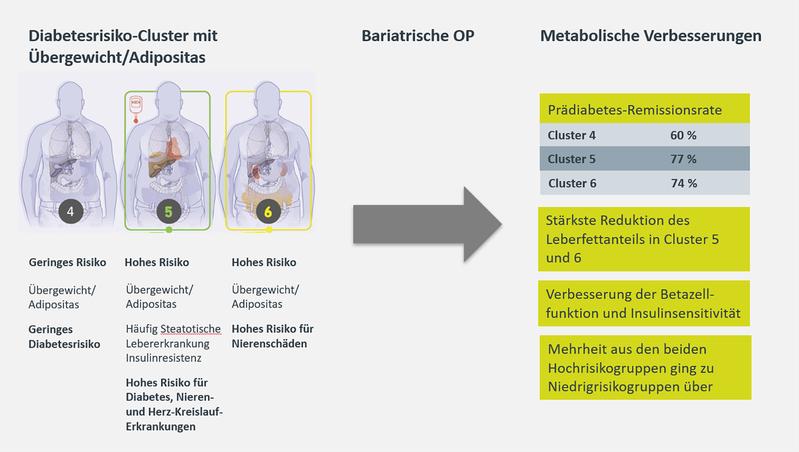 Menschen mit einem hohen Risiko für Typ-2-Diabetes und Folgeerkrankungen profitieren besonders stark von eine bariatrischen OP. 