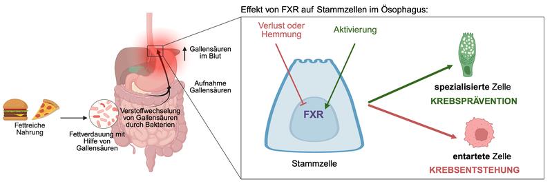 Die Aktivierung von FXR bestimmt das Schicksal der Stammzellen im Ösophagus (spezialisiert oder entartet) und beeinflusst somit die Entstehung des gastroösophagealen Adenokarzinoms.