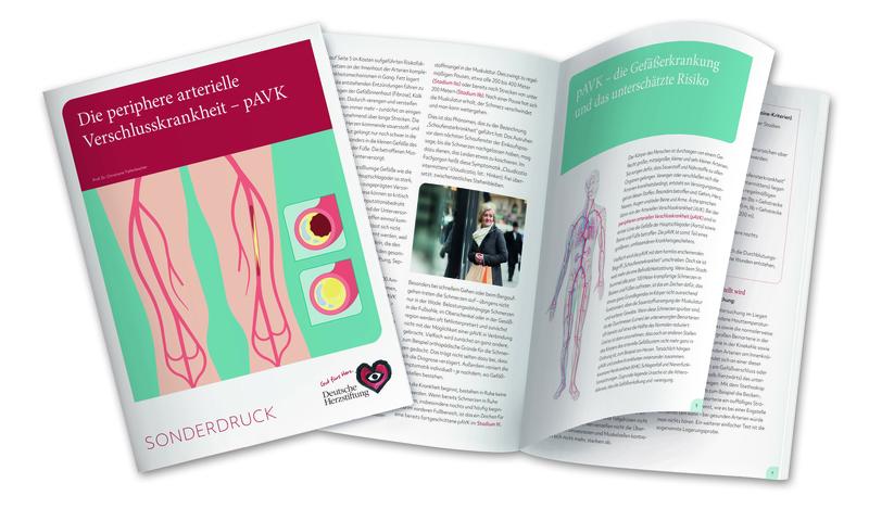 Der neue pAVK-Sonderdruck der Herzstiftung informiert über Ursachen, Symptome, Diagnose und Therapie der pAVK.