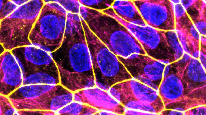 Die neuen Nanomedikamente zur Behandlung von Entzündungsprozessen in der Schwangerschaft sollen eine sichere Therapie für Mutter und Kind bieten. Im Bild: Das Plazenta-Modell unter dem Fluoreszenzmikroskop (blau: Zellkerne; gelb: Zell-zu-Zell-Kontakte).