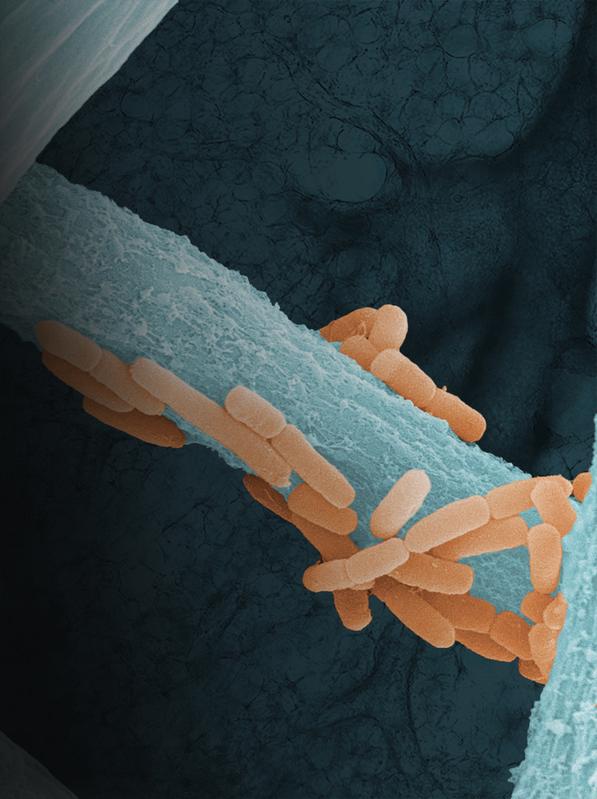 The growth of 𝘓𝘪𝘨𝘪𝘭𝘢𝘤𝘵𝘰𝘣𝘢𝘤𝘪𝘭𝘭𝘶𝘴 𝘮𝘶𝘳𝘪𝘯𝘶𝘴 (orange), a member of the murine lung microbiome, along the hyphae of the lung-pathogenic fungus 𝘈𝘴𝘱𝘦𝘳𝘨𝘪𝘭𝘭𝘶𝘴 𝘧𝘶𝘮𝘪𝘨𝘢𝘵𝘶𝘴 (blue), with lung tissue in the background. 