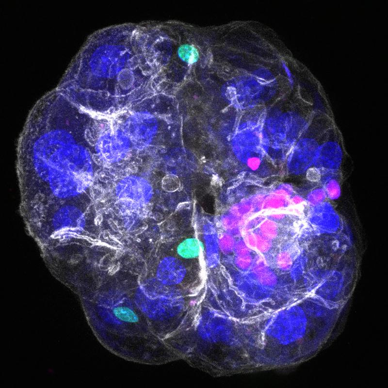 Periportal assembloid, with the three component cell types visualized: cholangiocytes in pink, portal fibroblasts in green, and hepatocyte nuclei in blue; all cell borders are visualized in white.