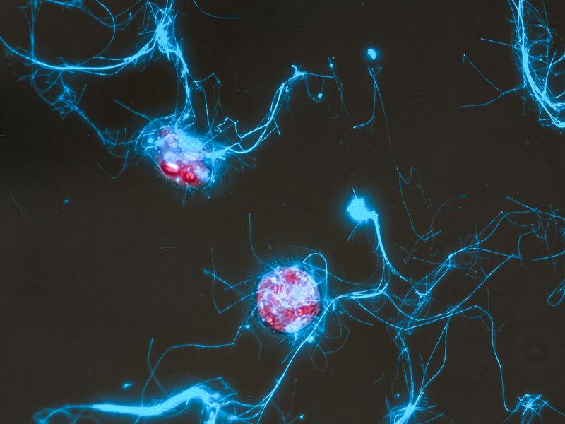 Die Kieselalge Conticribra weissflogii (rot) und die von ihr ausgeschiedenen Zuckerpolymerstrukturen (blau).