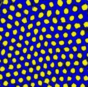 Sechseck-Muster, das spontan bei der Bildung eines selbst-strukturierenden Hydrogels entsteht. In den blauen Bereichen ist das Polymer weniger stark vernetzt als innerhalb der gelben Flecken.
