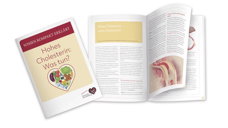 Kompaktes Wissen rund um hohes Cholesterin: der kostenfreie Herzstiftungs-Ratgeber "Hohes Cholesterin: Was tun?"