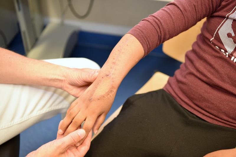 Der Heilungsprozess an der operierten Hand verläuft sehr zufriedenstellend.
