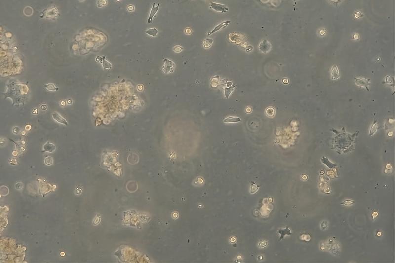 Cytopathic effects on host cells by viruses (100 x)